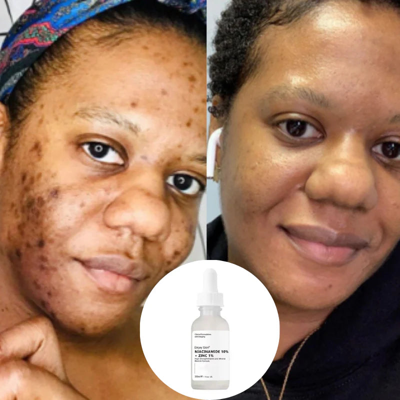 Le sérum The Ordinary Niacinamide
