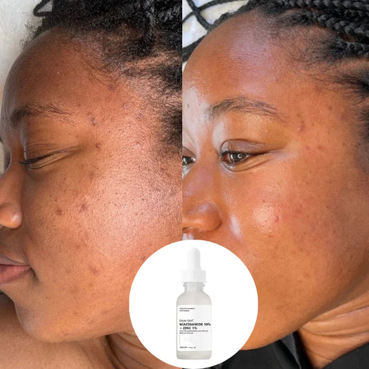 Le sérum The Ordinary Niacinamide
