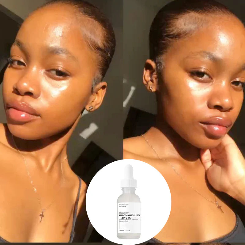 Le sérum The Ordinary Niacinamide